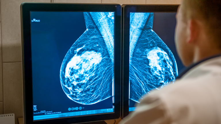 Breast augmentation scans